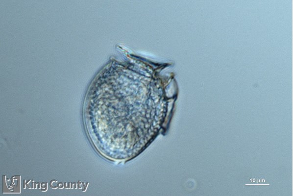 Photo of Dinophysis acuminata